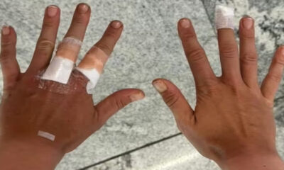 Brazilska teniserka Beatriz Hadad Maja. njene ruke