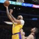 Entoni Dejvis NBA obrva